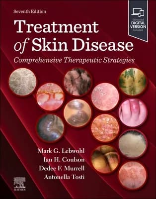 (영문도서)Treatment of Skin Disease: Comprehensive Therapeutic Strategies, Hardcover 가격 추이 (영문도서)Treatment of Skin Disease: Comprehensive Therapeutic Strategies, Hardcover - 최저가 419,400원